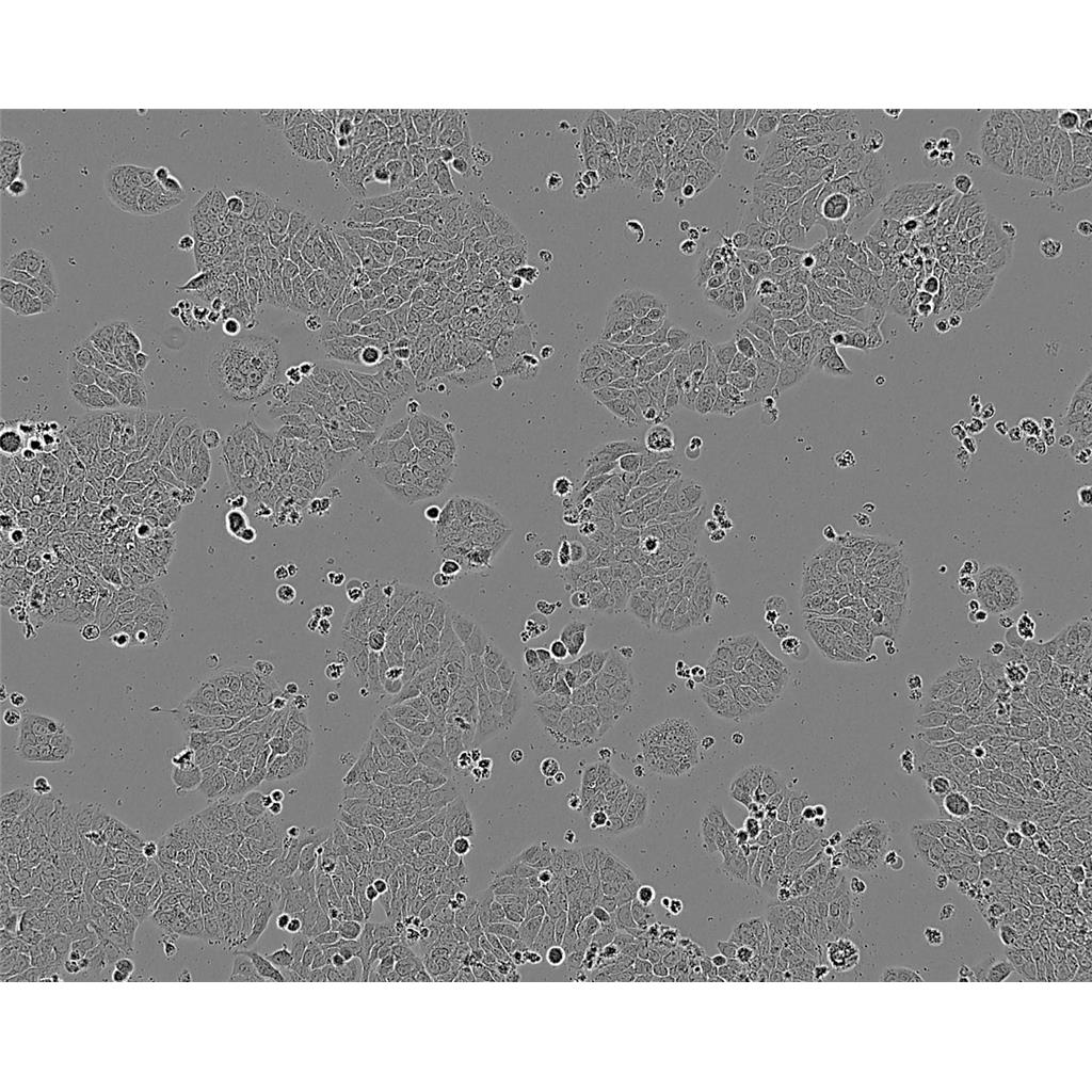 ACHN/GFP Cells人腎細(xì)胞腺癌貼壁細(xì)胞系<綠色熒光標(biāo)記>(贈(zèng)送STR基因圖譜),ACHN/GFP Cells