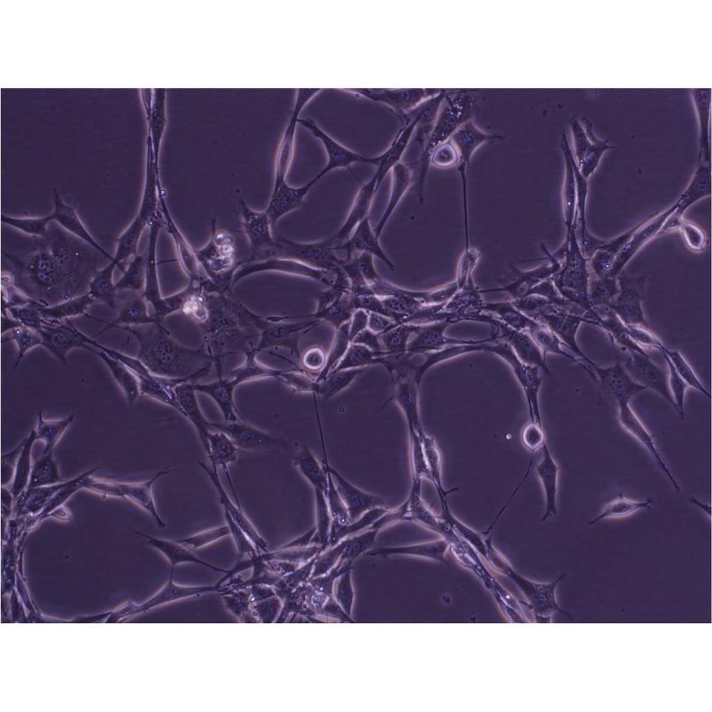 NCI-H647 Cells人肺癌貼壁細(xì)胞系(贈(zèng)送STR基因圖譜),NCI-H647 Cells