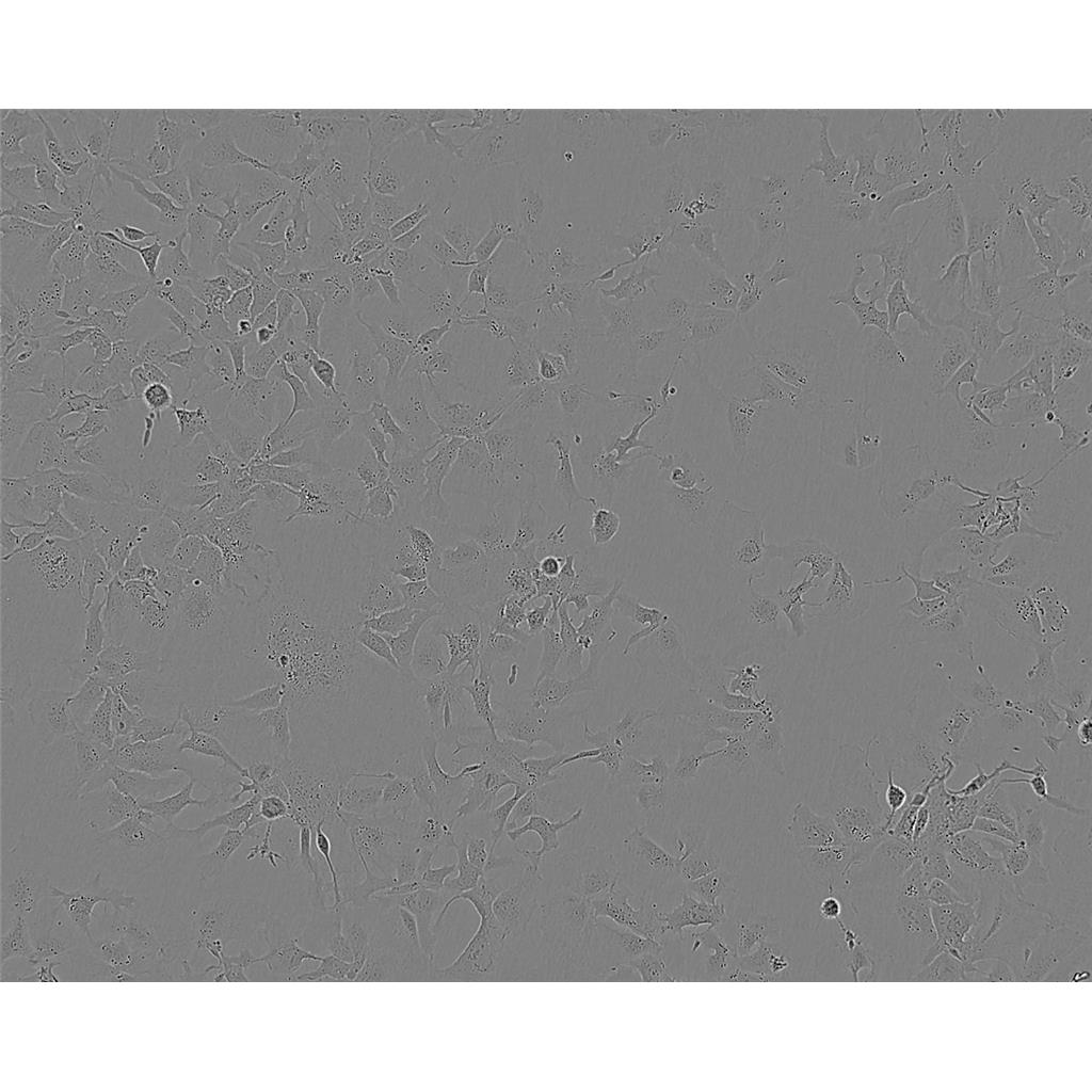 Hela 229 Cells人宮頸癌貼壁細(xì)胞系(贈(zèng)送STR基因圖譜),Hela 229 Cells