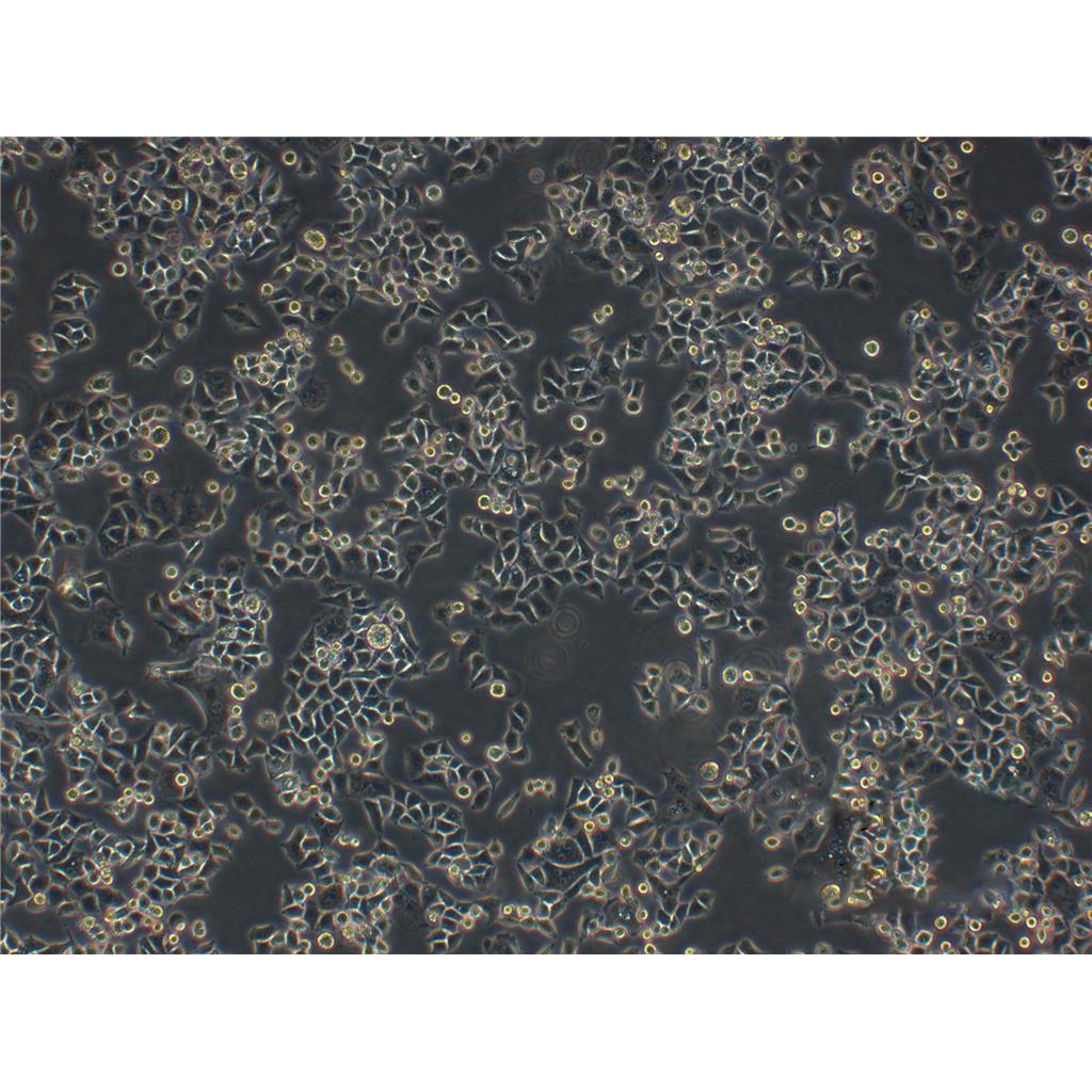 MM.1S Cells人多發(fā)性骨髓瘤貼壁細(xì)胞系(贈送STR基因圖譜),MM.1S Cells