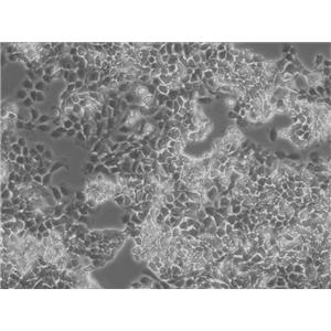 CL-11 Cells人结肠癌贴壁细胞系(赠送STR基因图谱)