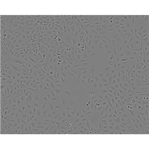 UM-SCC-1 Cells人口底鳞癌贴壁细胞系(赠送STR基因图谱)