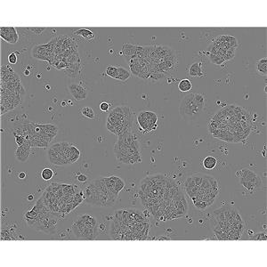 KMS-11 Cells人多發(fā)性骨髓瘤克隆貼壁細(xì)胞系(贈送STR基因圖譜)