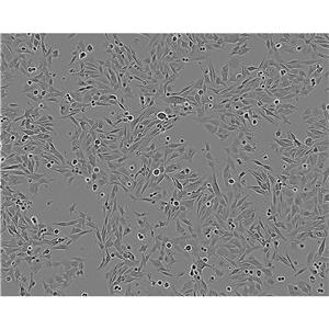 HCE-T Cells人角膜上皮贴壁细胞系(赠送STR基因图谱)