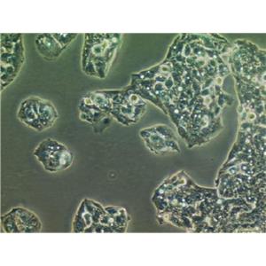 HARA-B Cells人肺鳞状细胞癌贴壁细胞系(赠送STR基因图谱)