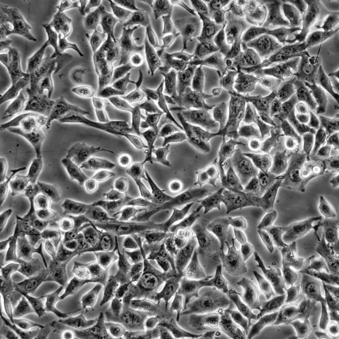 MES-SA Cells人子宮肉瘤貼壁細(xì)胞系(提供所有細(xì)胞STR鑒定圖譜),MES-SA Cells