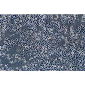 769-P Cells#人腎細(xì)胞腺癌細(xì)胞系保種中心(通過STR鑒定)