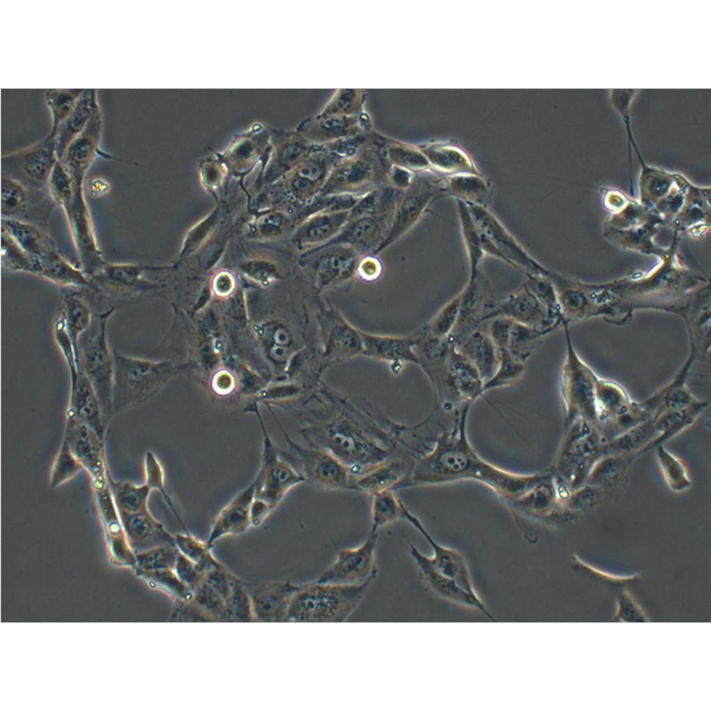 KG-1 Cells急性髓系細胞白血病可傳代細胞系(送STR鑒定圖譜),KG-1 Cells