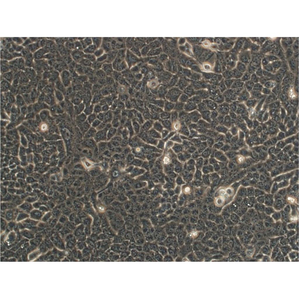 HKb20 Cells#人腎上皮細胞系保種中心(通過STR鑒定),HKb20 Cells