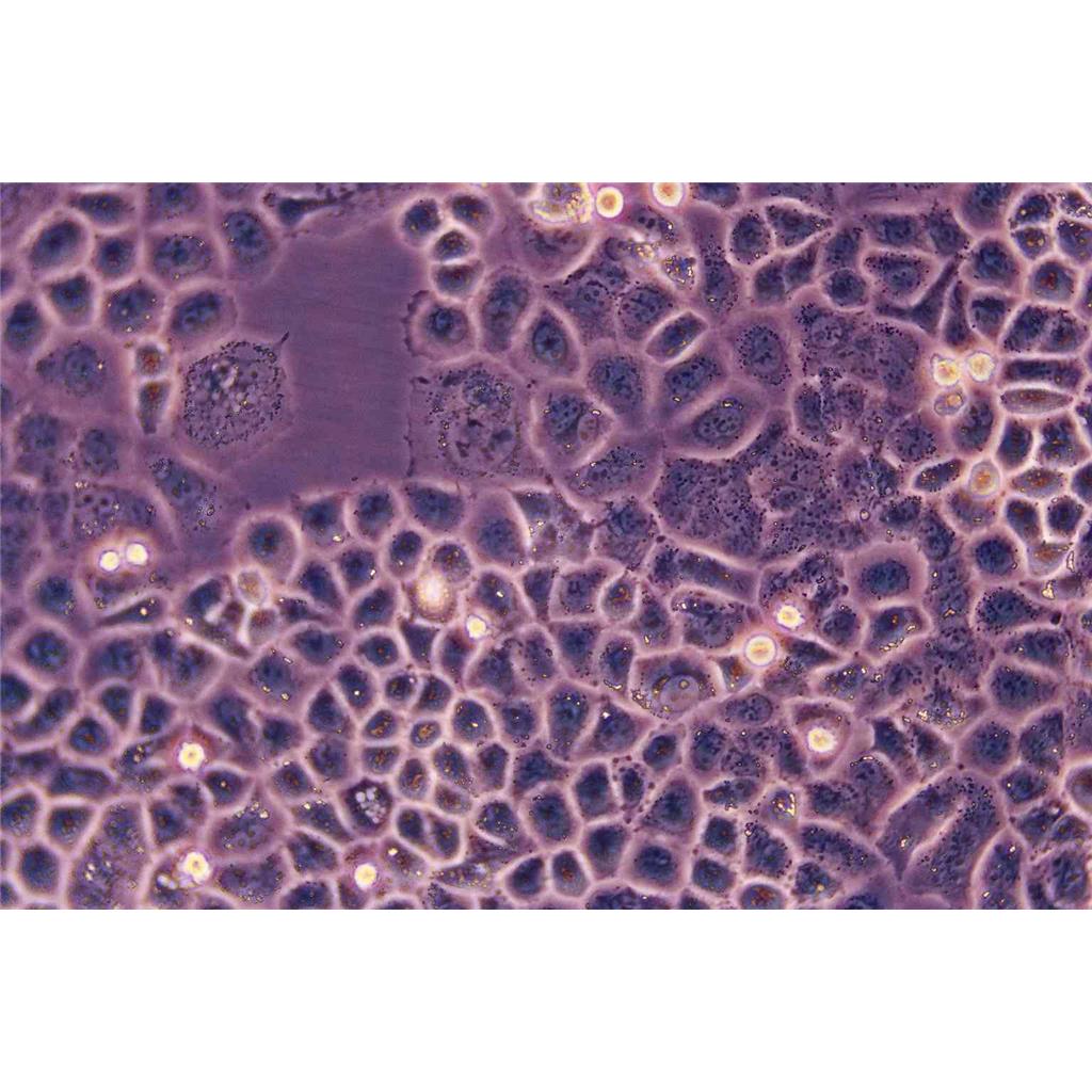 NCI-H196 Cells#人小細(xì)胞肺癌細(xì)胞系保種中心(通過STR鑒定),NCI-H196 Cells#