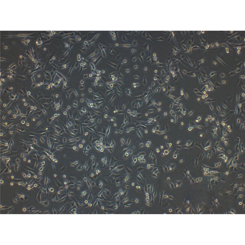 DU4475 Cells#人乳腺上皮細(xì)胞系保種中心(通過(guò)STR鑒定),DU4475 Cells#