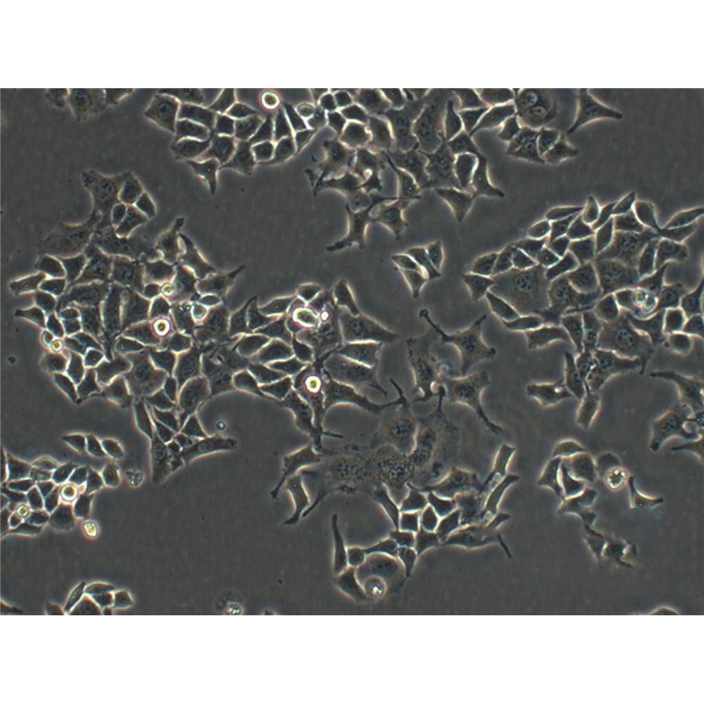 SK-LU-1 Cells#人低分化肺腺癌細胞系保種中心(通過STR鑒定),SK-LU-1 Cells#