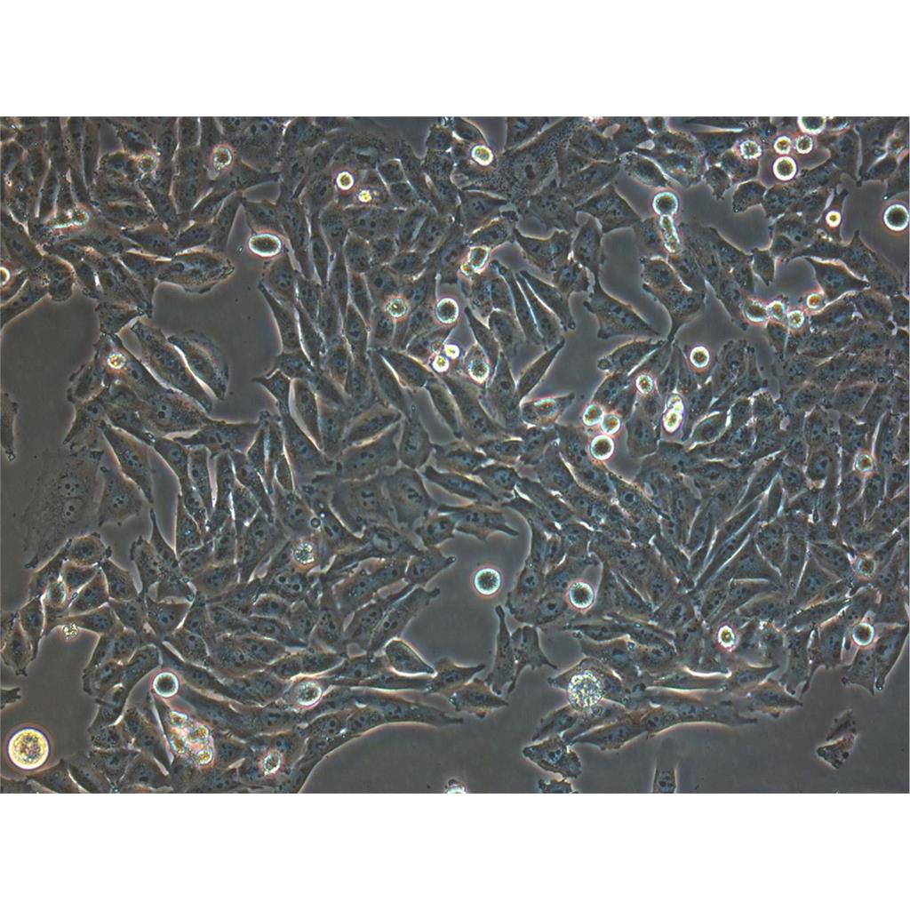 SJSA-1 Cells#人骨肉瘤細(xì)胞系保種中心(通過STR鑒定),SJSA-1 Cells#