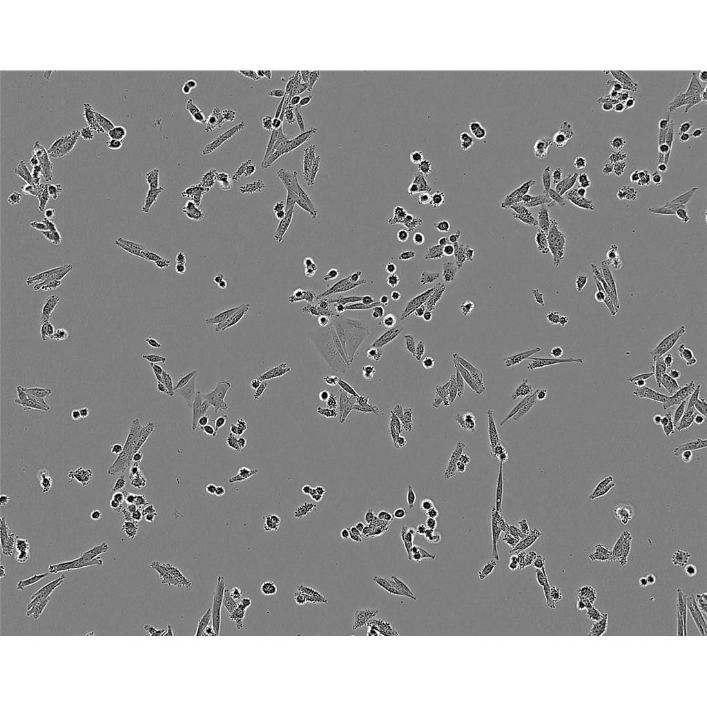 FTC-133 Cells#人濾泡狀甲狀腺癌細胞系保種中心(通過STR鑒定),FTC-133 Cells#