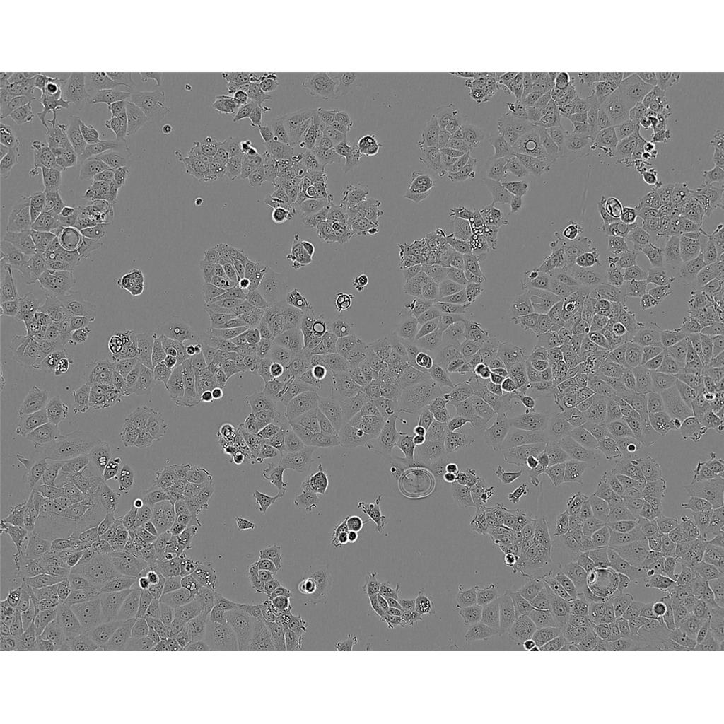 KYSE-150 Cells#人食管鱗癌細胞系保種中心(通過STR鑒定),KYSE-150 Cells#