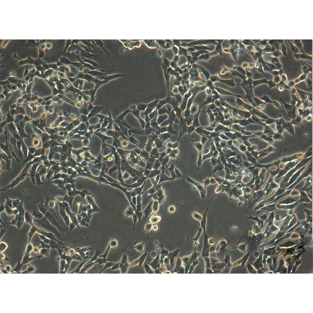 L-M[TK-] Cells小鼠結(jié)締組織可傳代細胞系(送STR鑒定圖譜),L-M[TK-] Cells