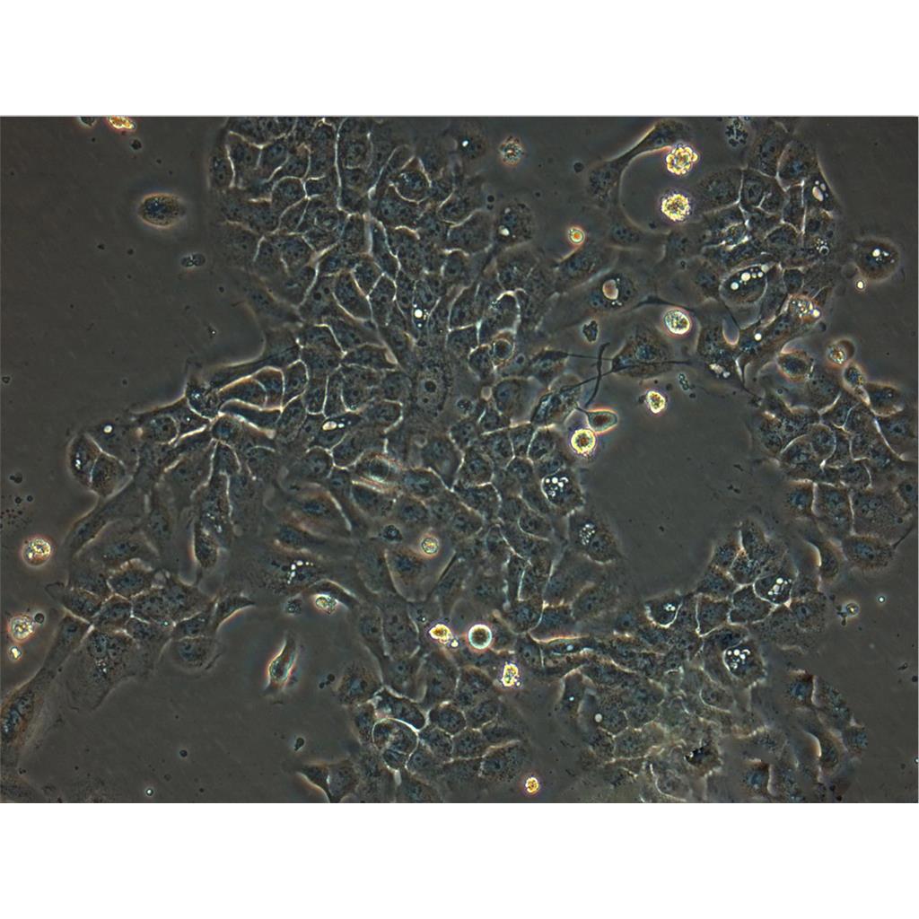 SKOV-3 Cells人卵巢癌可傳代細(xì)胞系(送STR鑒定圖譜),SKOV-3 Cells