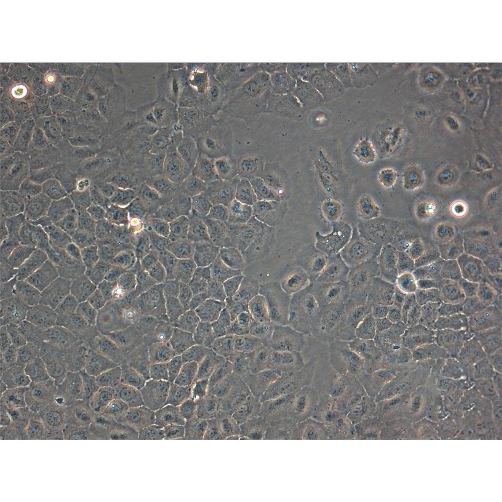 6-T CEM Cells人T細(xì)胞白血病可傳代細(xì)胞系(送STR鑒定圖譜),6-T CEM Cells