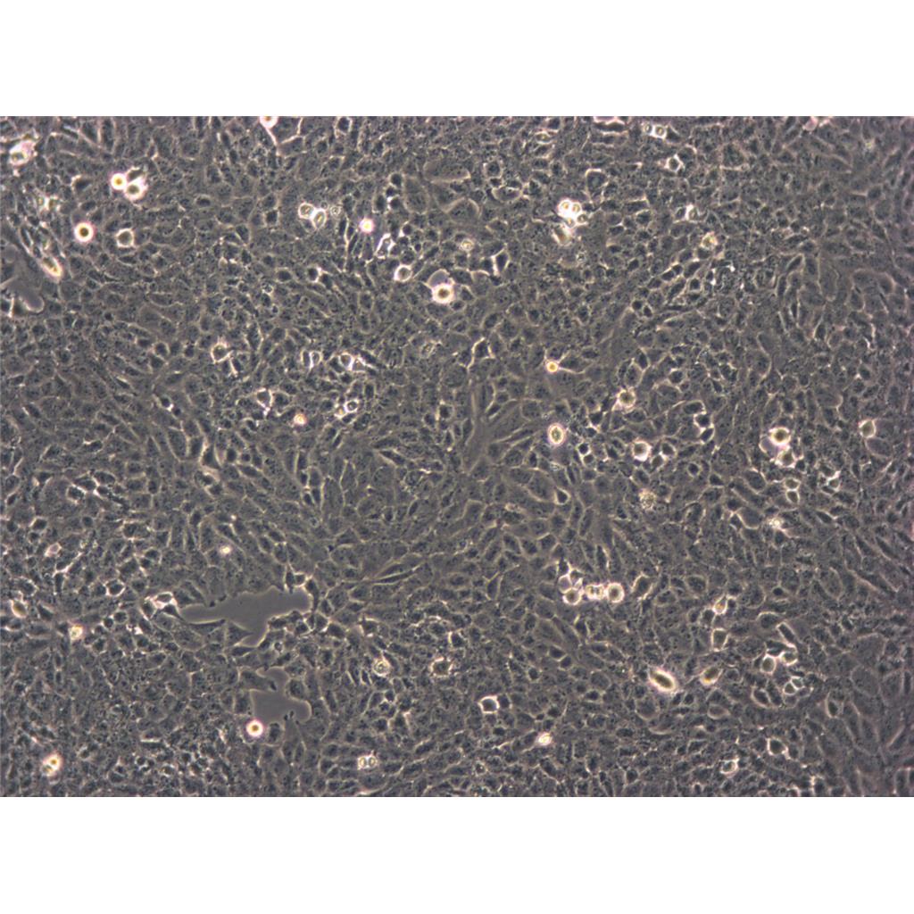 H2170 Cells人肺鱗癌可傳代細(xì)胞系(送STR鑒定圖譜),H2170 Cells