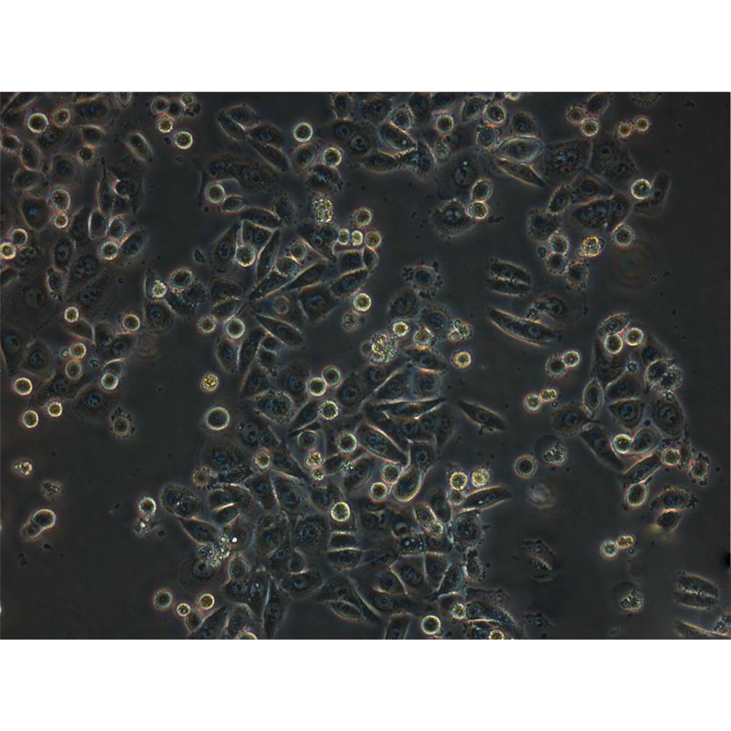 H209 Cells人小細胞肺癌可傳代細胞系(送STR鑒定圖譜),H209 Cells