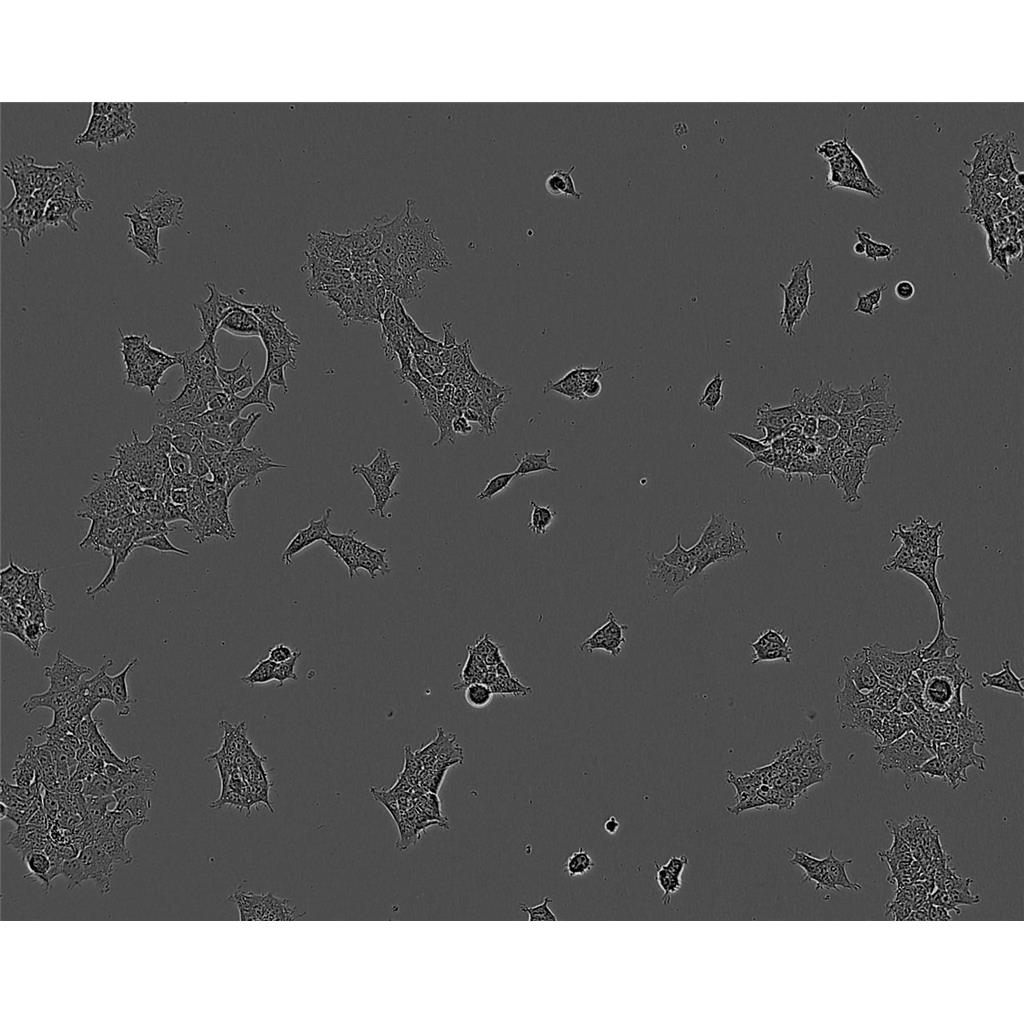 mda MB 175 VII Cells人乳腺導(dǎo)管癌可傳代細(xì)胞系(送STR鑒定圖譜),mda MB 175 VII Cells