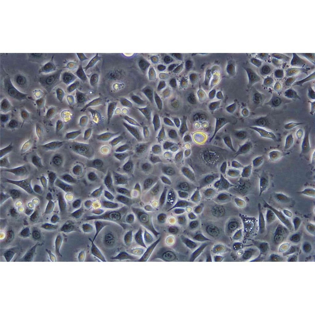 B16/F10 Cells小鼠黑色素瘤可傳代細(xì)胞系(送STR鑒定圖譜),B16/F10 Cells