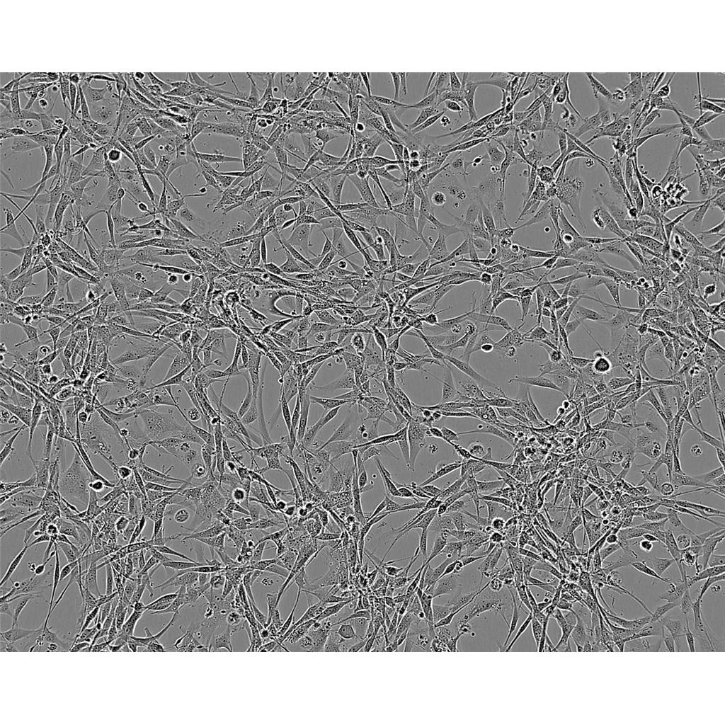 M-NFS-60 CellsG-CSF依賴性小鼠白血病可傳代細胞系(送STR鑒定圖譜),M-NFS-60 Cells