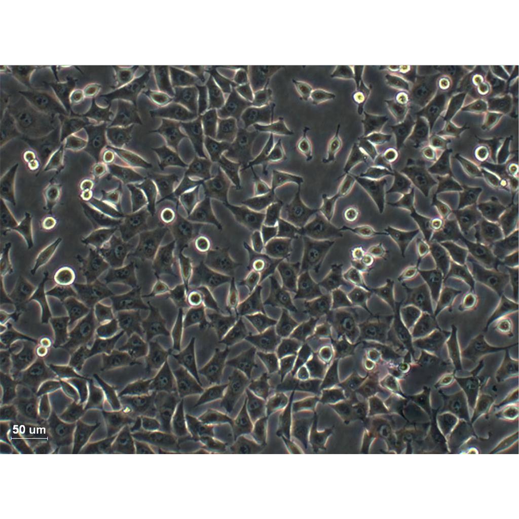 mda-MB 453 Cells人乳腺癌可傳代細胞系(送STR鑒定圖譜),mda-MB 453 Cells