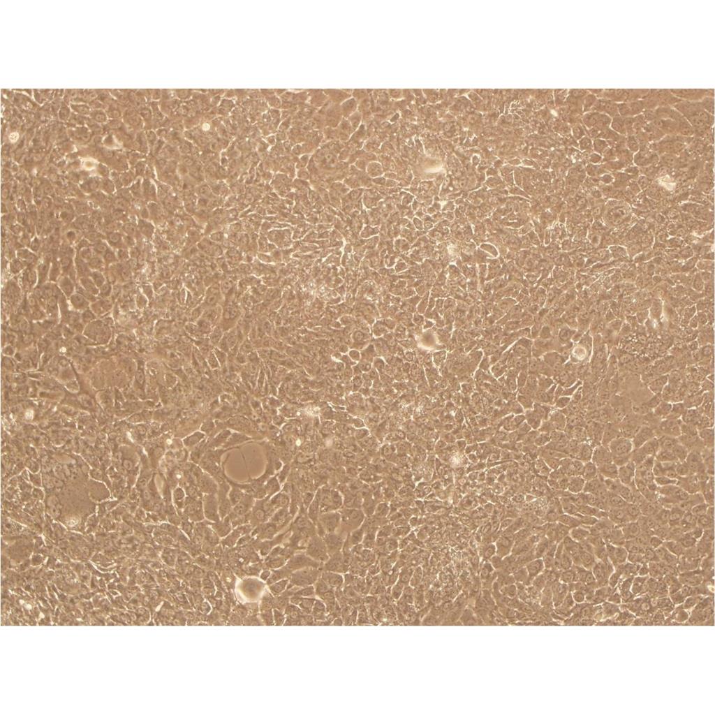 ES2 Cells人卵巢癌可傳代細(xì)胞系(送STR鑒定圖譜),ES2 Cells