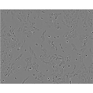 HCC4006 Cells#人肺癌腺癌細(xì)胞系保種中心(通過STR鑒定)