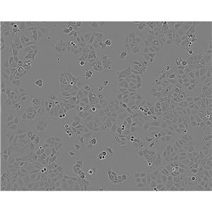 KYSE-150 Cells#人食管鳞癌细胞系保种中心(通过STR鉴定)