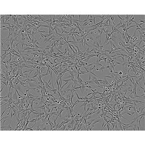 M-NFS-60 CellsG-CSF依賴性小鼠白血病可傳代細胞系(送STR鑒定圖譜),M-NFS-60 Cells