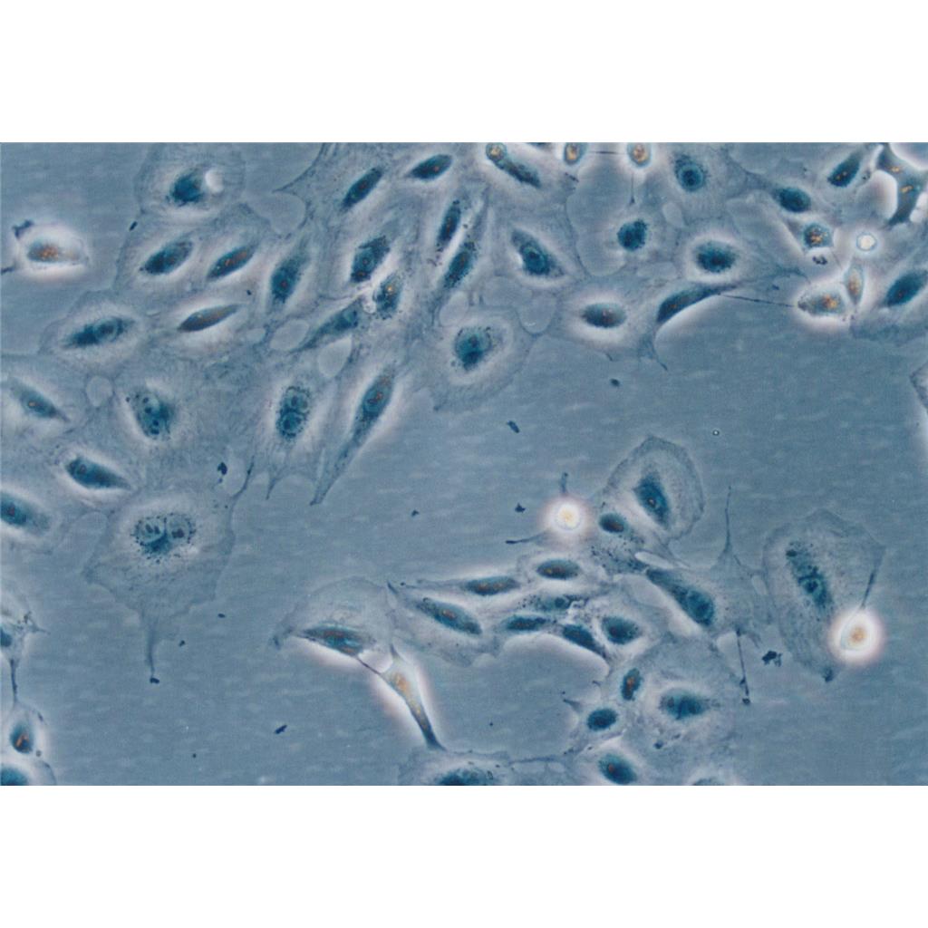 IHH-4 Cells#人甲狀腺乳頭狀癌細(xì)胞系保種中心(通過(guò)STR鑒定),IHH-4 Cells#