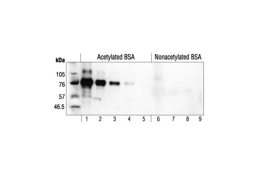 乙?；嚢彼峥贵w,Acetylated-Lysine Antibody