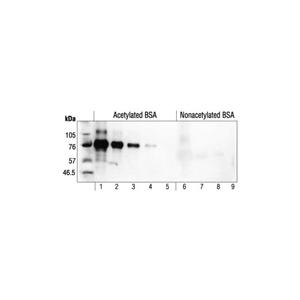 乙?；嚢彼峥贵w,Acetylated-Lysine Antibody