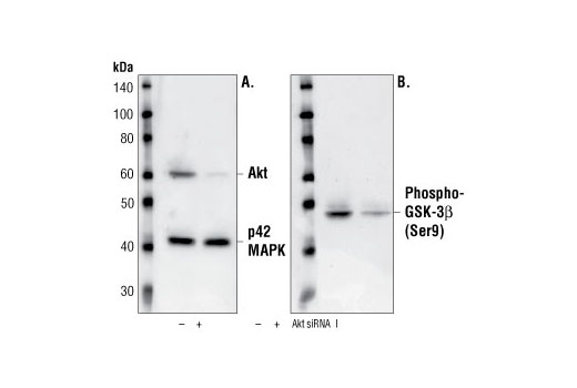 CST 蛋白激酶B抗體,Akt Antibody