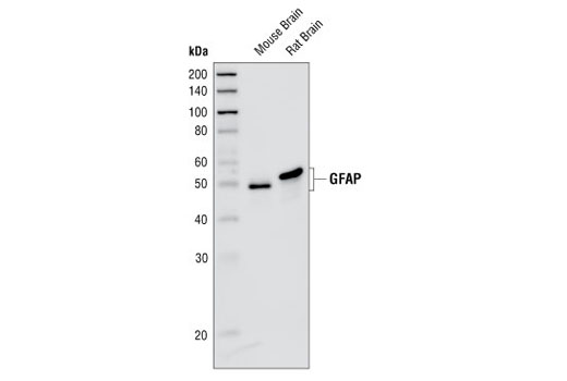 膠質(zhì)纖維酸性蛋白（GA5）小鼠單克隆抗體,GFAP (GA5) Mouse mAb