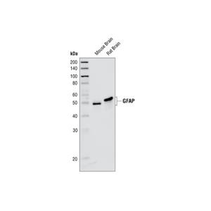 膠質(zhì)纖維酸性蛋白（GA5）小鼠單克隆抗體,GFAP (GA5) Mouse mAb