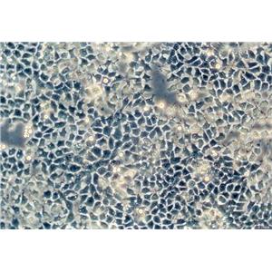 NCIH441 Cells#人肺腺癌細(xì)胞系種子庫(kù)|完全培養(yǎng)基|STR圖譜