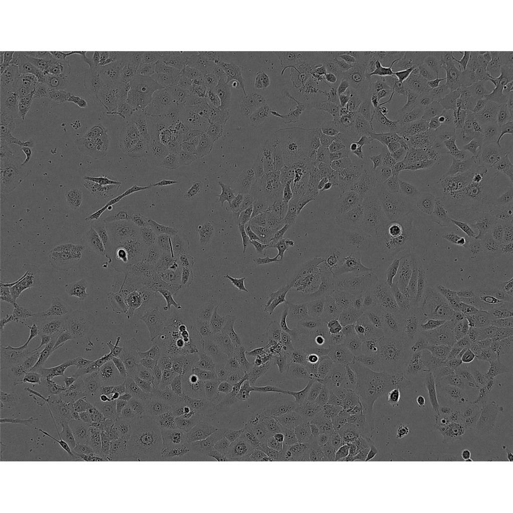 NCI-H929 Cells#人骨髓瘤細(xì)胞系來源可靠|培養(yǎng)基|帶STR基因圖譜,NCI-H929 Cells#