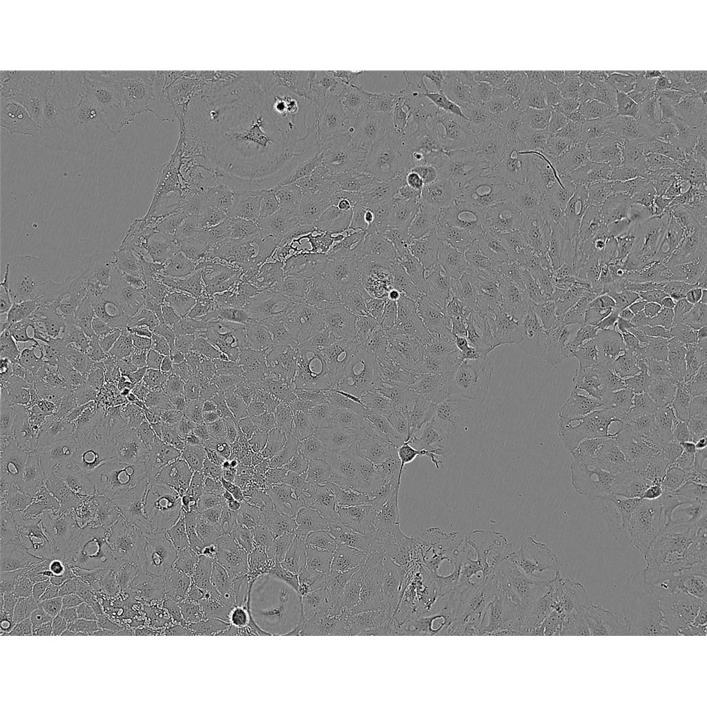 SK-N-SH Cells#人神經(jīng)母細(xì)胞瘤細(xì)胞系來(lái)源可靠|培養(yǎng)基|帶STR基因圖譜,SK-N-SH Cells#