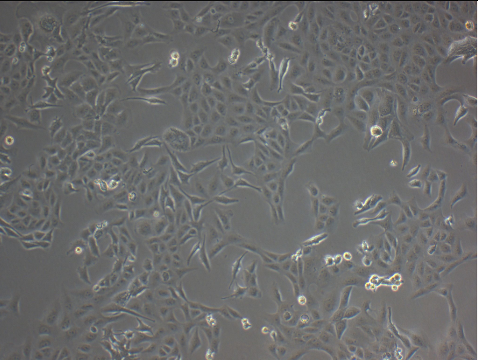 mda-453 Cells#人乳腺癌細(xì)胞系種子庫(kù)|完全培養(yǎng)基|STR圖譜,mda-453 Cells#