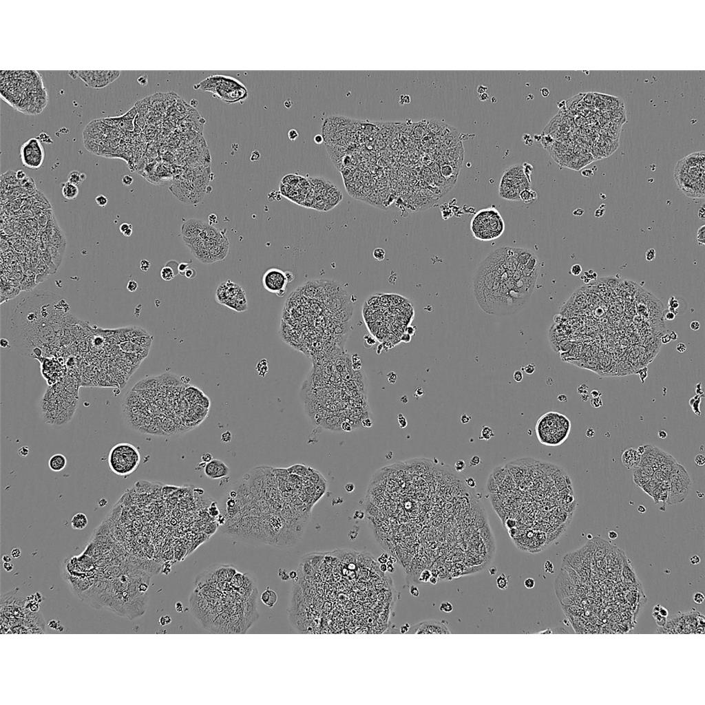 NIH:OVCAR3 Cells#人卵巢腺癌細(xì)胞系種子庫|完全培養(yǎng)基|STR圖譜,NIH:OVCAR3 Cells#