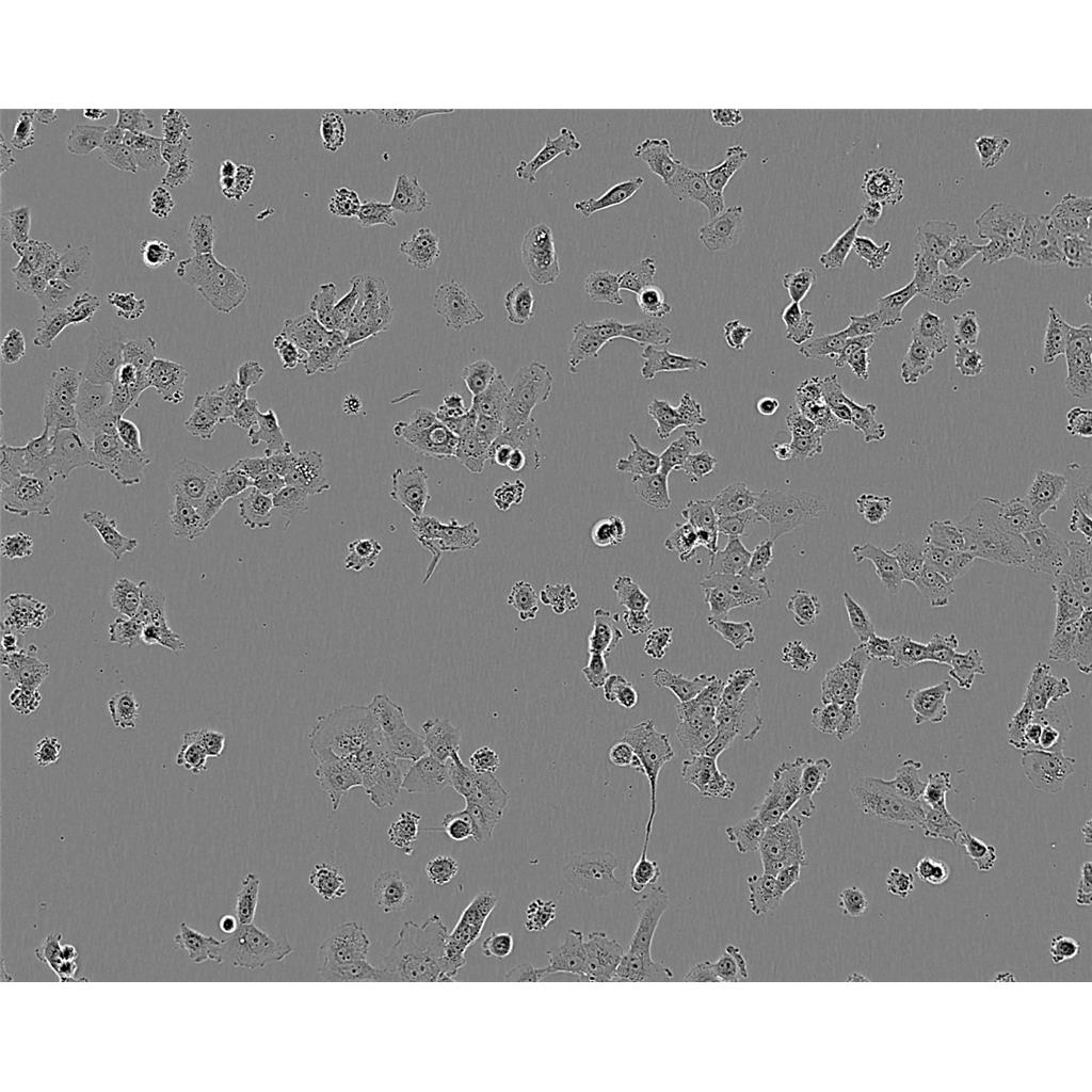 HUCCT1 Cells#人膽管癌細(xì)胞系種子庫(kù)|完全培養(yǎng)基|STR圖譜,HUCCT1 Cells#