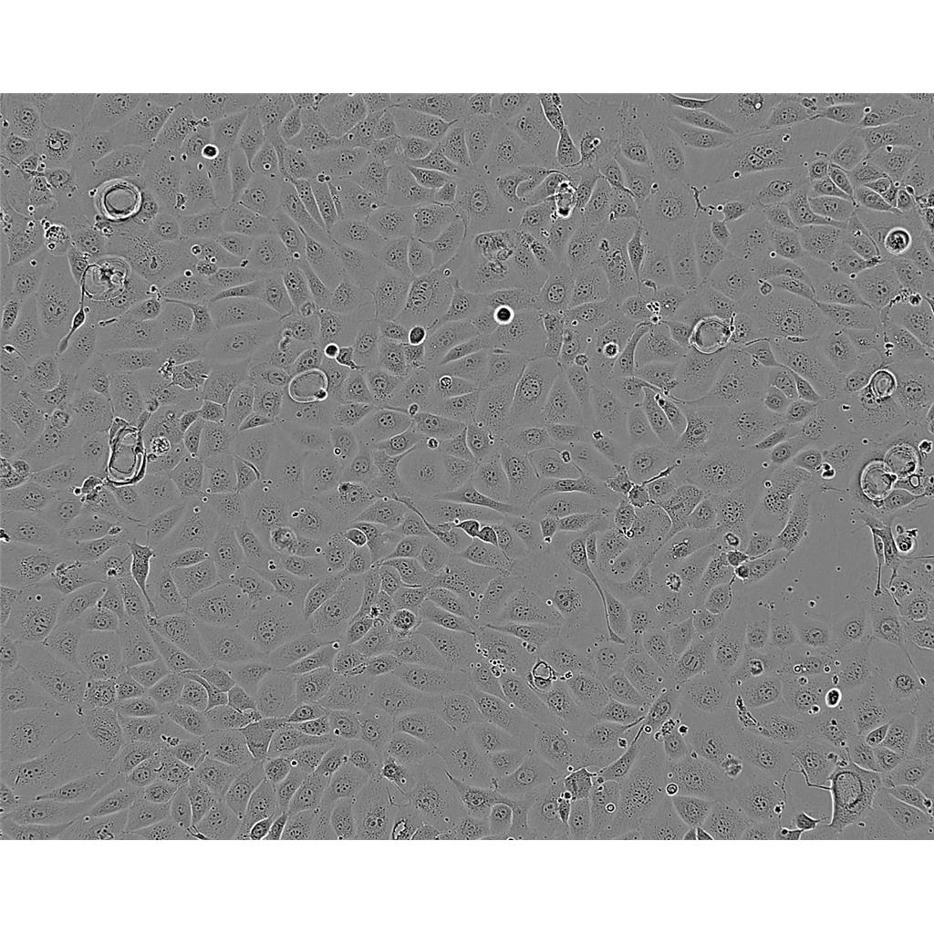 MV4:11 Cells#人急性單核細(xì)胞系種子庫|完全培養(yǎng)基|STR圖譜,MV4:11 Cells#