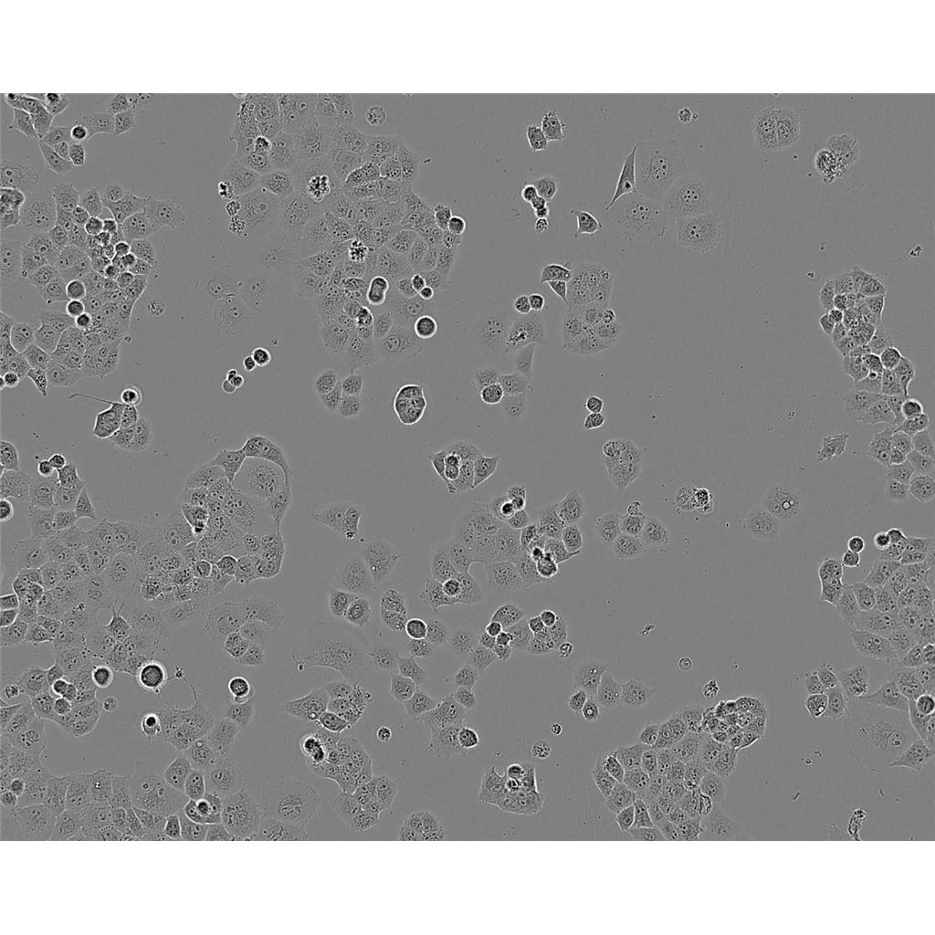 NCIH2452 Cells#人間皮瘤細胞系種子庫|完全培養(yǎng)基|STR圖譜,NCIH2452 Cells#