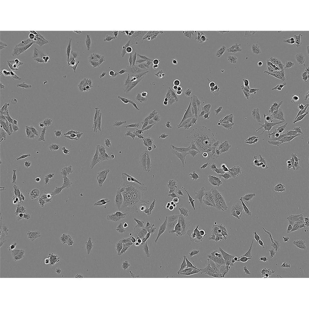 MCA38 Cells#結(jié)腸癌細(xì)胞系種子庫|完全培養(yǎng)基|STR圖譜,MCA38 Cells#