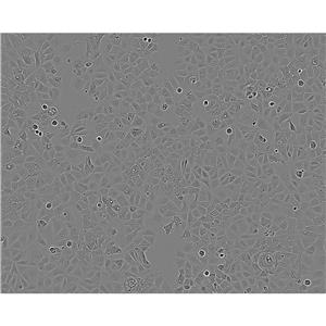 NCI-H1395 Cells#人肺腺癌細(xì)胞系來(lái)源可靠|培養(yǎng)基|帶STR基因圖譜