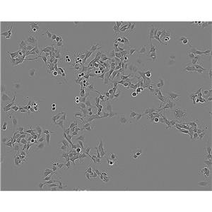 EA.hy926 Cells#人脐静脉细胞融合细胞系来源可靠|培养基|带STR基因图谱