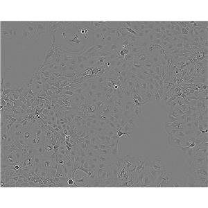 SK-N-SH Cells#人神經(jīng)母細胞瘤細胞系來源可靠|培養(yǎng)基|帶STR基因圖譜